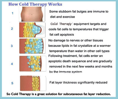 Cold Therapy how it works